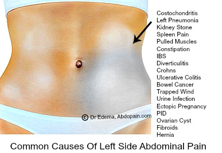 What are possible causes of right side groin pain in women?