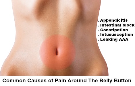 What is a leaky belly button?