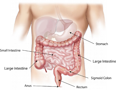 Obstruction in your small bowel could lead to pains around your belly button
