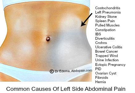 sharp pain on left side of stomach