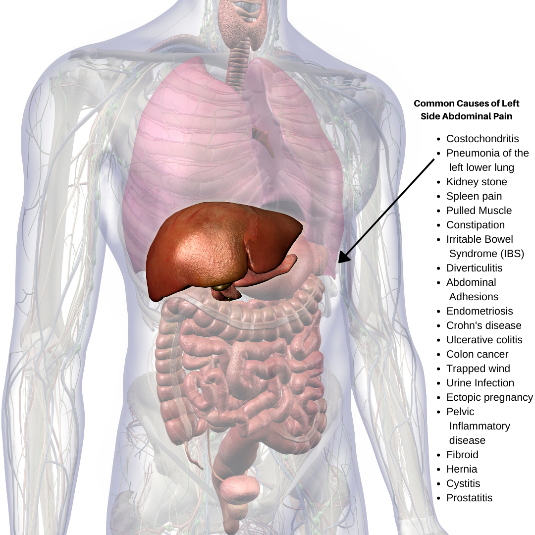 Common causes of left side abdominal pain.