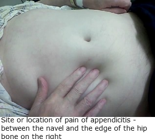 Location of appendicitis pain - The right lower abdomen or just above the waist line on the right side.