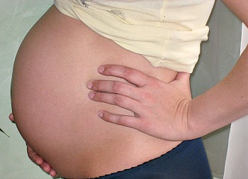 Cholestasis of pregnancy