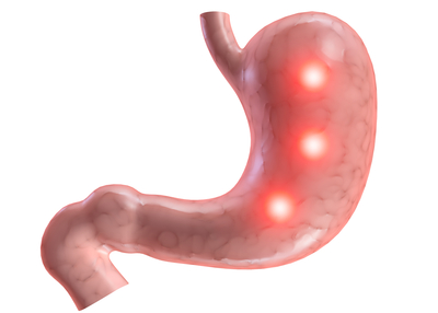 stomach pains breast bone Bad ghetto bitches ass