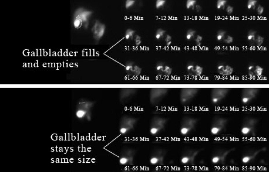 A Hida scan result.