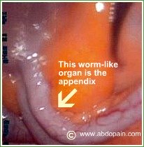 True picture of the appendix