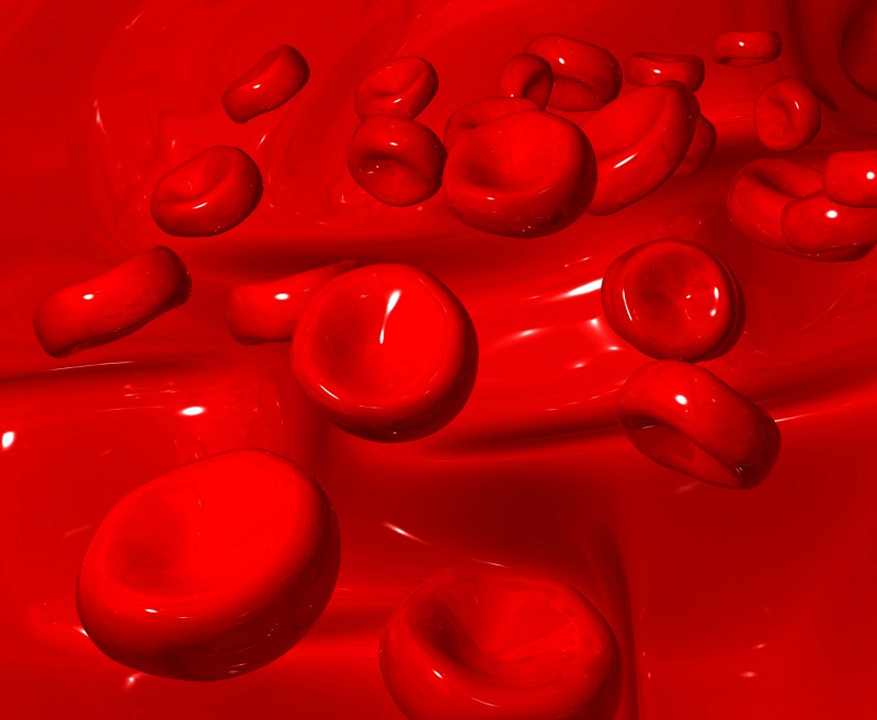 Hemochromatosis: This is a condition that leads to overload of iron in our body from excessive intestinal absorption of iron from our diet.
