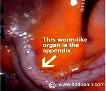Picture of the appendix