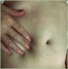 Upper Right Abdominal Pain