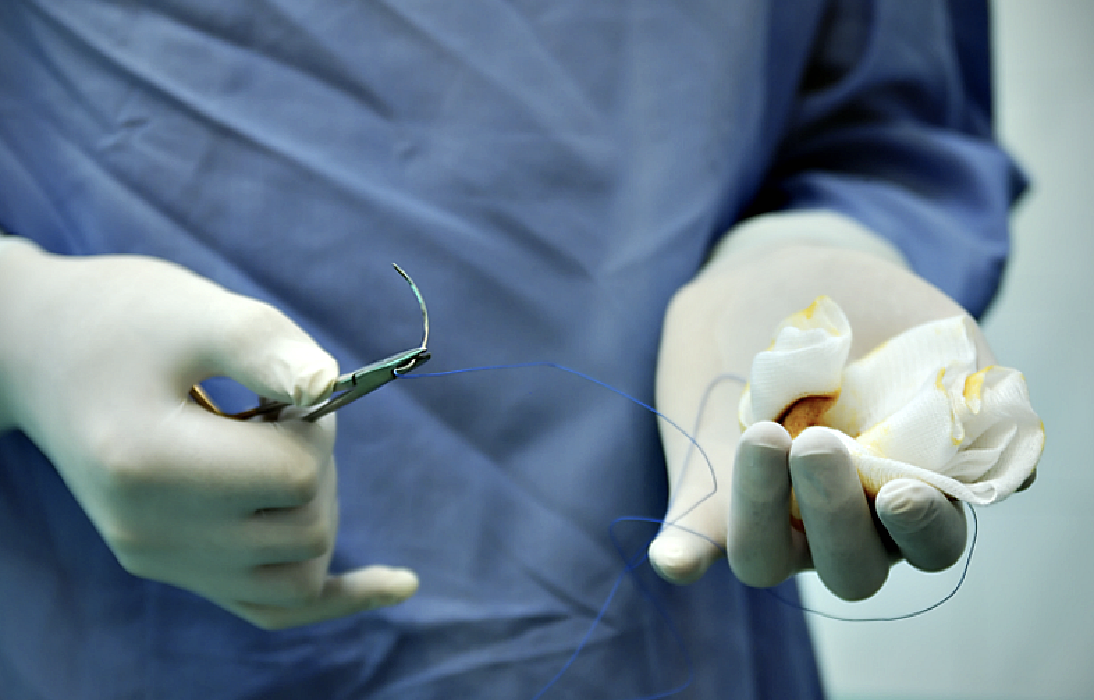 Surgical procedures that cause abdominal adhesion.