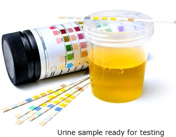 Urine infection can occur in newborn babies too